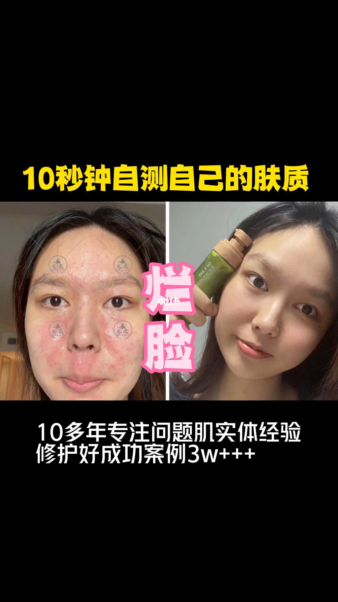 {21點}(皮肤科医院哪个医院最好)